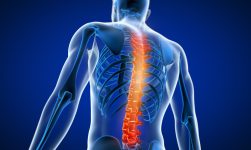 Osteoporoza