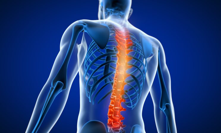 Osteoporoza