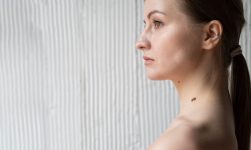 afecțiuni dermatologice
