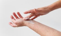 psoriazisul