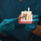 implant dentar